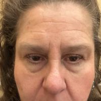 Ana Pesce - Advanced Skin Technology ico