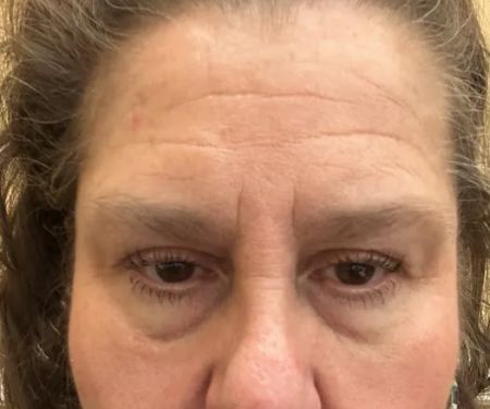 Ana Pesce - Advanced Skin Technology