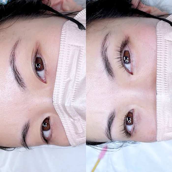 Epidedmy Skin Care Philadelphia Picture 7