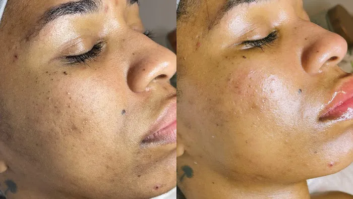 Epidedmy Skin Care Philadelphia Picture 6