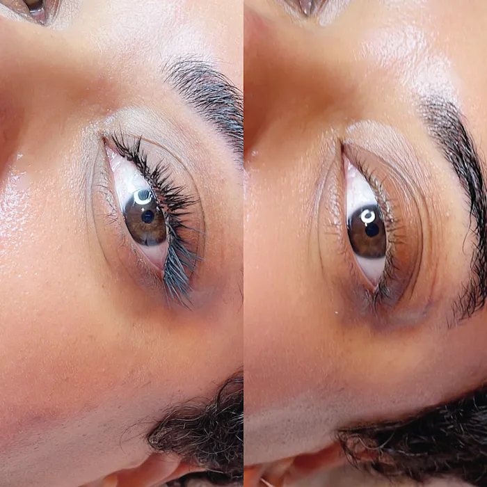 Epidedmy Skin Care Philadelphia Picture 10