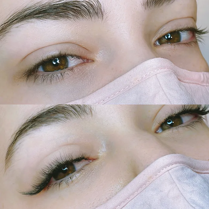 Epidedmy Skin Care Philadelphia Picture 8