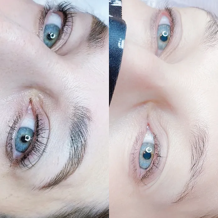 Epidedmy Skin Care Philadelphia Picture 9