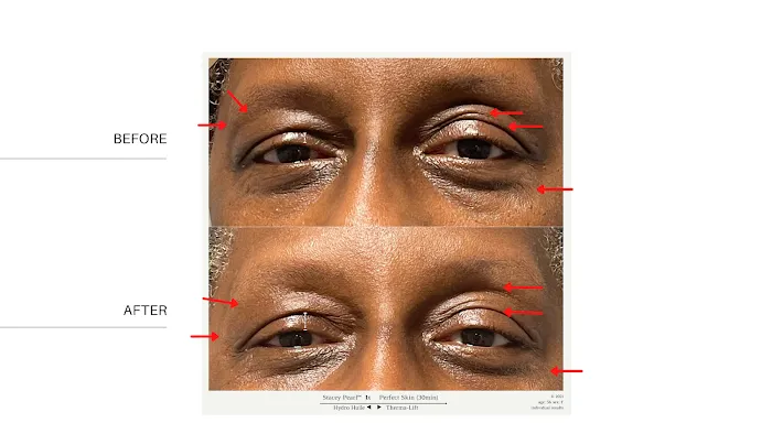 Hi-Tech and Plant-based SkinCare | Stacey Pearl Skin Science & Technology Picture 4