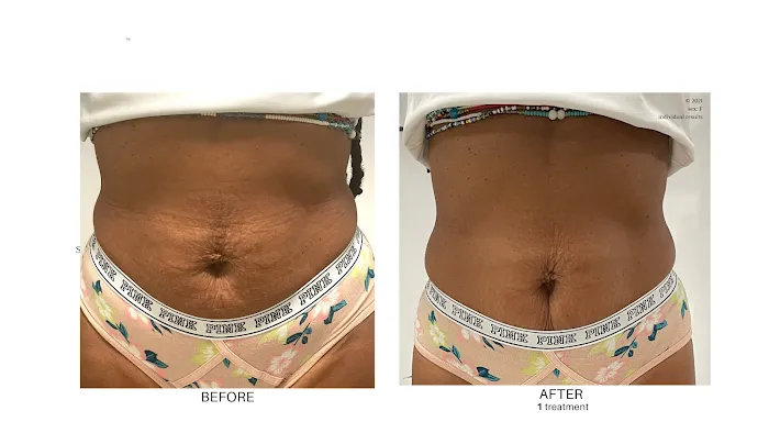 Hi-Tech and Plant-based SkinCare | Stacey Pearl Skin Science & Technology Picture 6