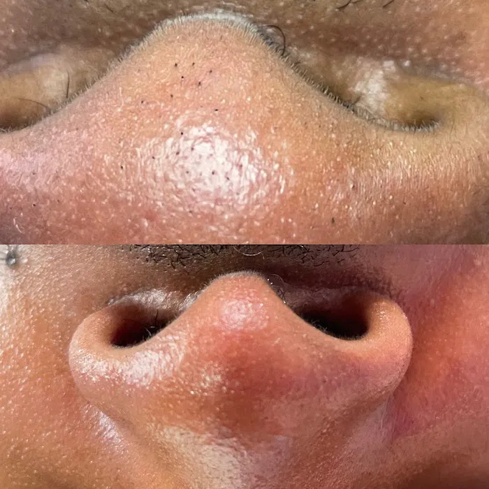 Skincare Bruja - The Philly Esthetician Picture 2