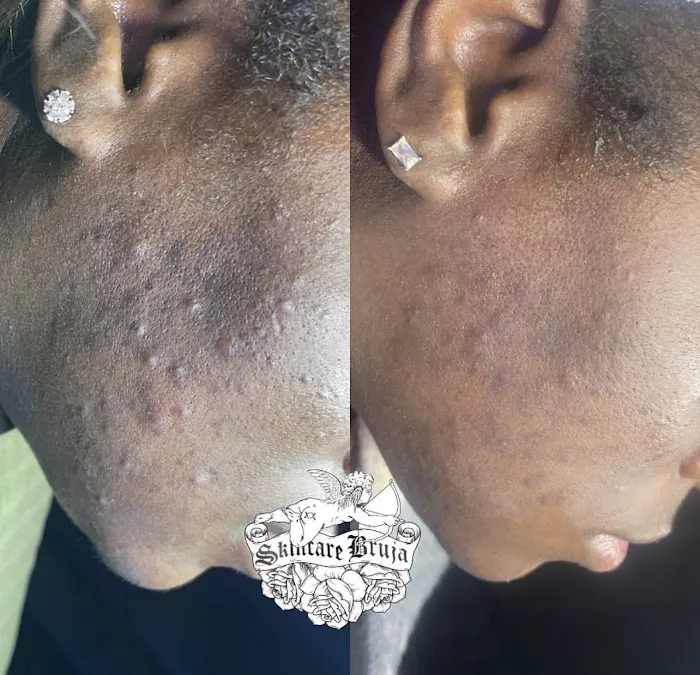 Skincare Bruja - The Philly Esthetician Picture 3