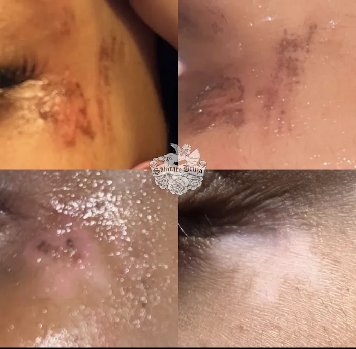 Skincare Bruja - The Philly Esthetician Picture 5