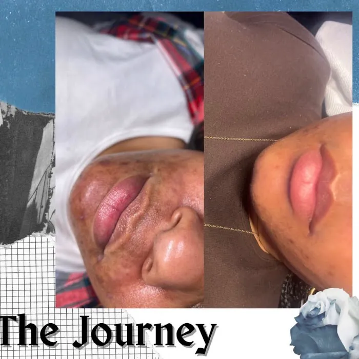 Skincare Bruja - The Philly Esthetician Picture 6