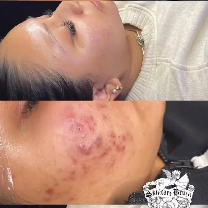 Skincare Bruja - The Philly Esthetician Picture 4