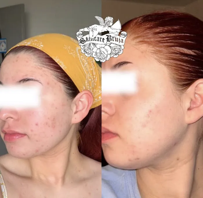 Skincare Bruja - The Philly Esthetician Picture 8