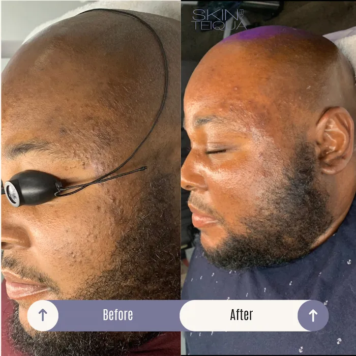 Skin By Teiqua Picture 5