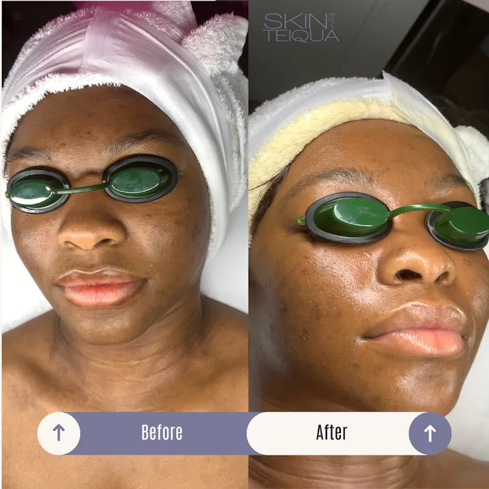 Skin By Teiqua Picture 6