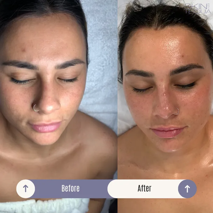 Skin By Teiqua Picture 8