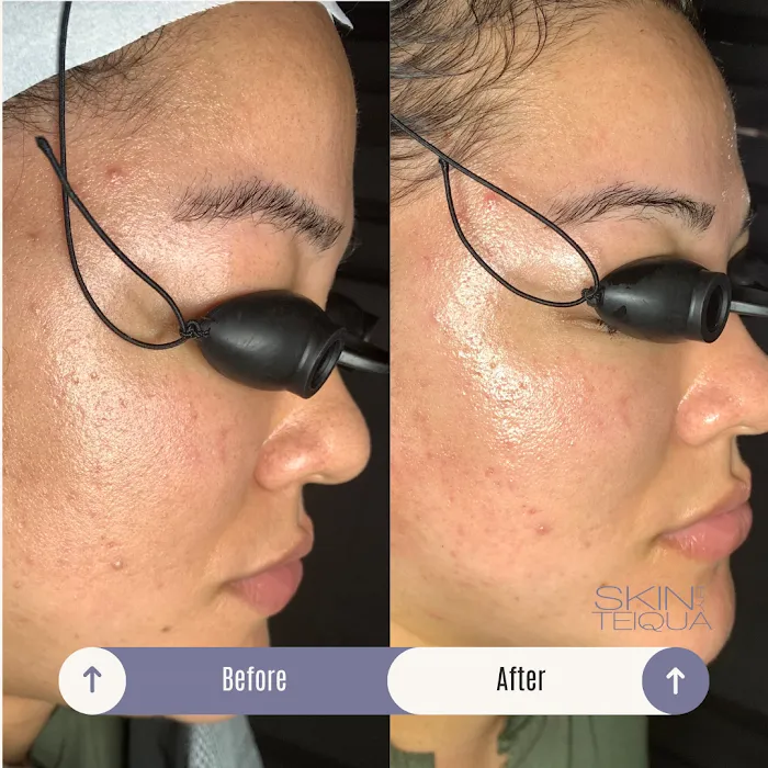 Skin By Teiqua Picture 7