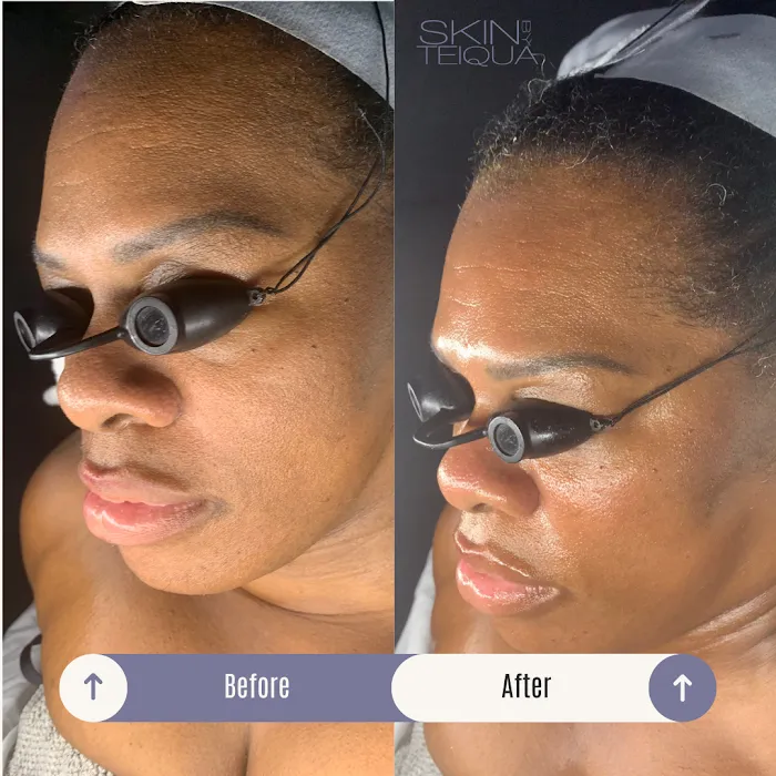 Skin By Teiqua Picture 10