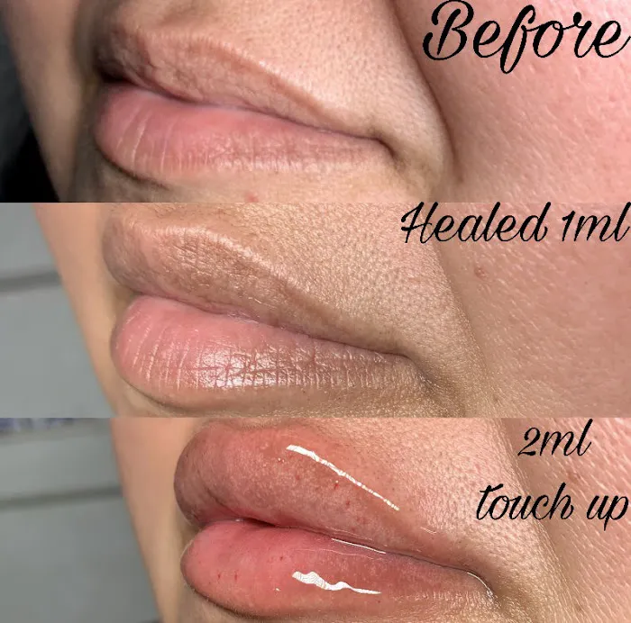 Rejuvenile Aesthetics Picture 2