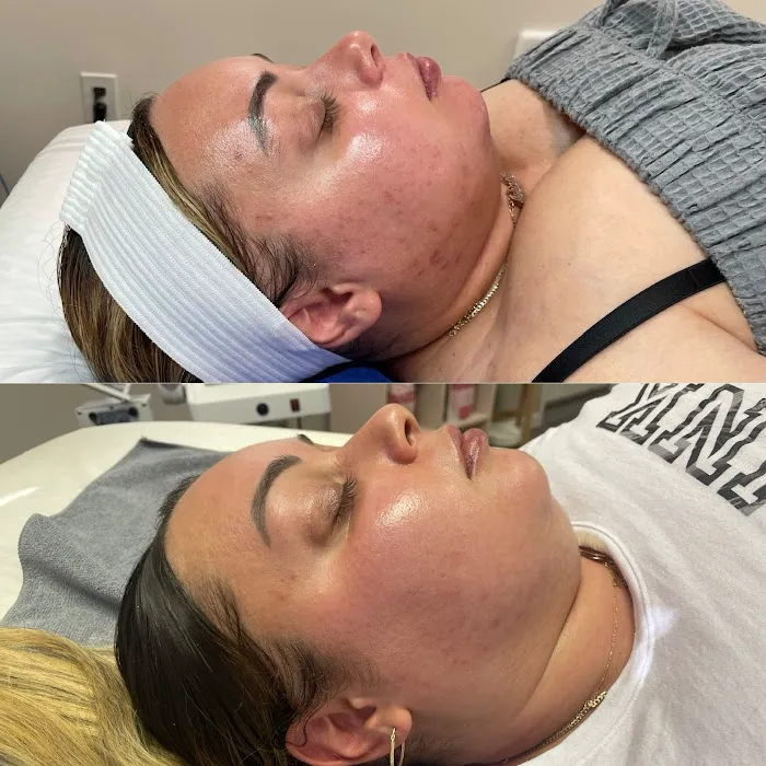 Uncovered Beauty Picture 1