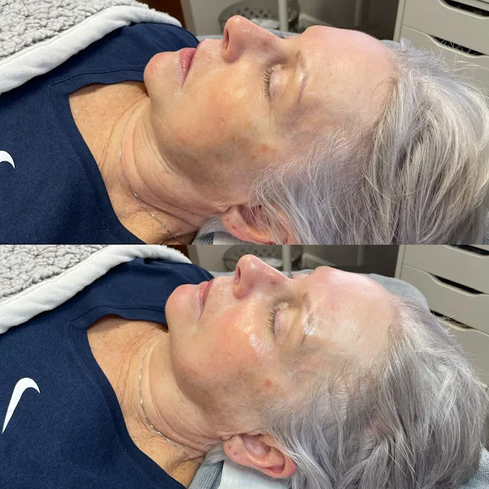 Uncovered Beauty Picture 5