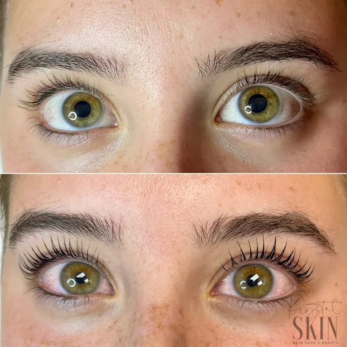 Krystal Skin Studio Picture 10