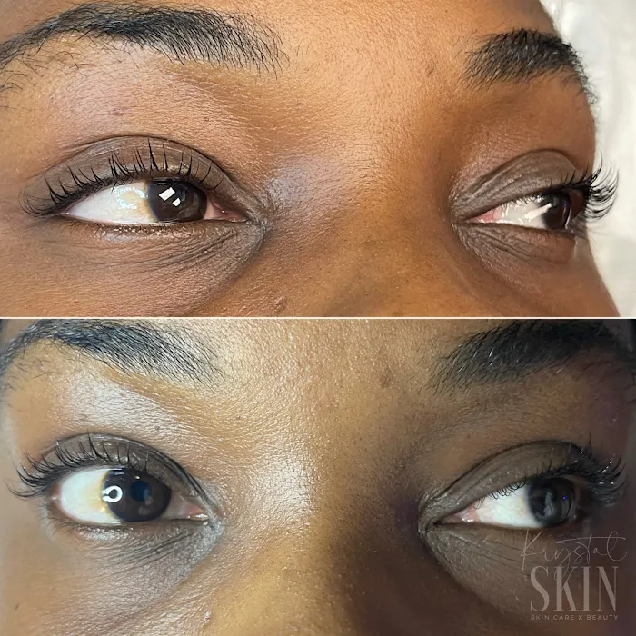 Krystal Skin Studio Picture 9