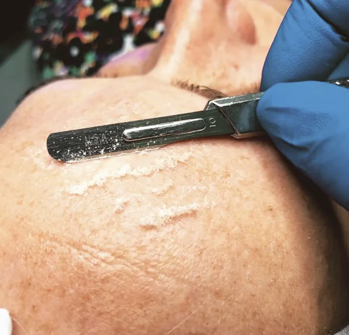 Dani Causey Skin Picture 7