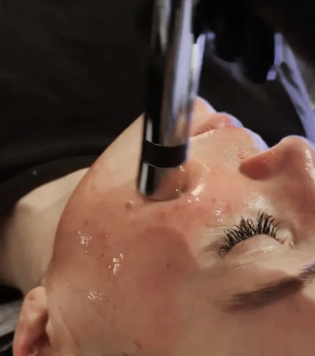 Dani Causey Skin Picture 9