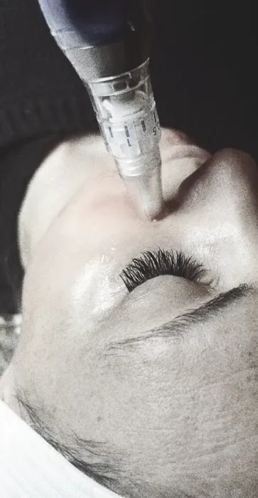 Dani Causey Skin Picture 8