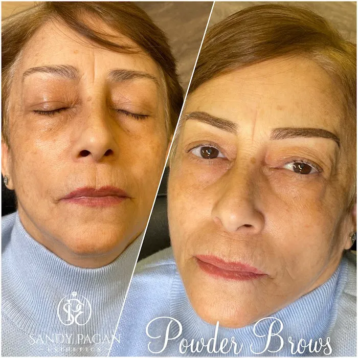 Sandy Pagan Esthetics Picture 9