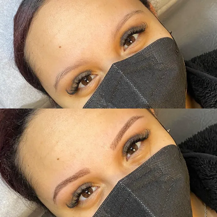 Laser Perfection Picture 2