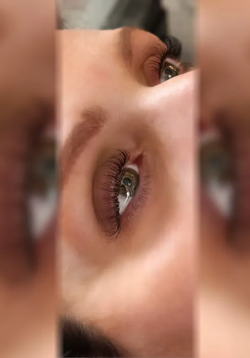 Laser Perfection Picture 1