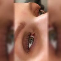 Laser Perfection ico