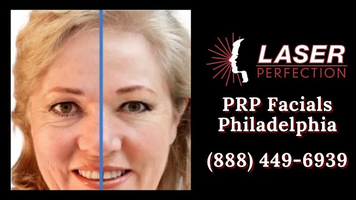 Laser Perfection Picture 4