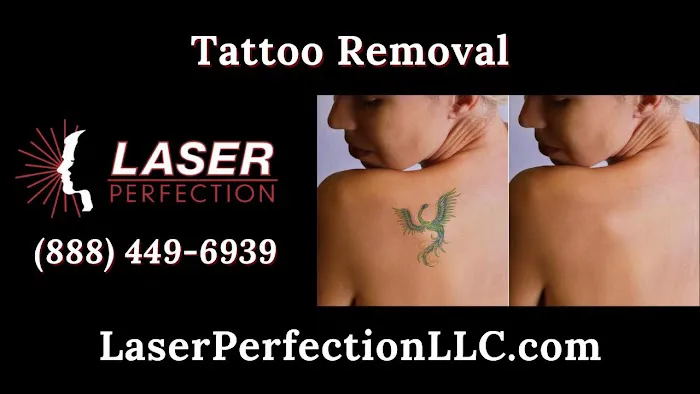 Laser Perfection Picture 9