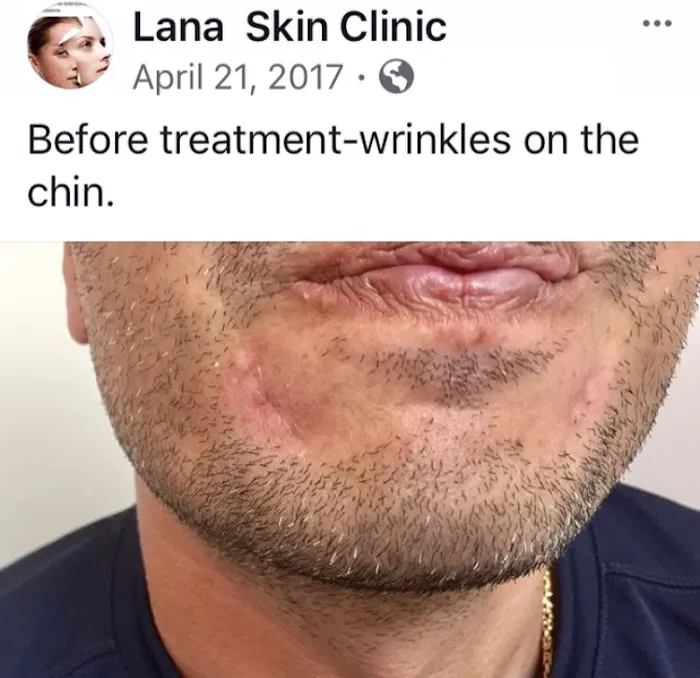 LANA SKIN CLINIC Picture 10