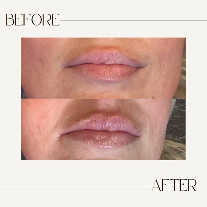 Little Needles by Gianna Rossi, PA-C Picture 2