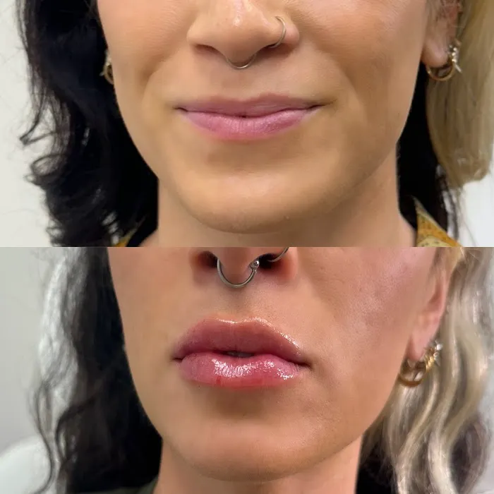 Little Needles by Gianna Rossi, PA-C Picture 5