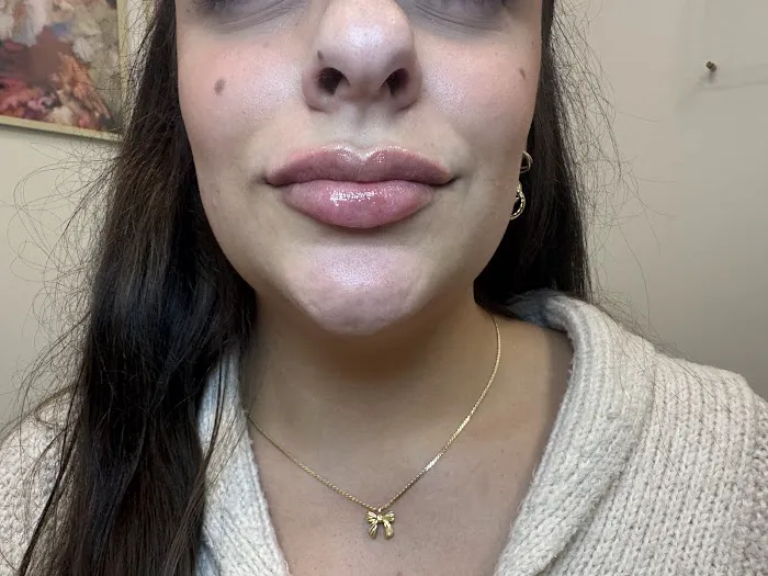 Little Needles by Gianna Rossi, PA-C Picture 10