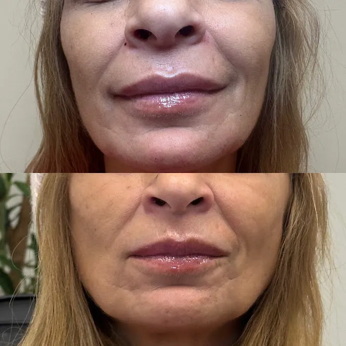 Little Needles by Gianna Rossi, PA-C Picture 9