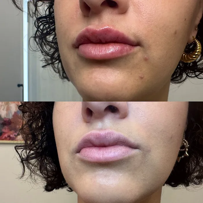 Little Needles by Gianna Rossi, PA-C Picture 8