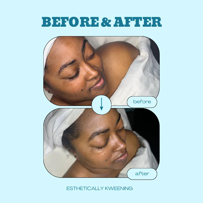 Esthetically Kweening Picture 7