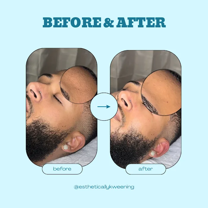 Esthetically Kweening Picture 8