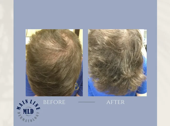 Main Line Dermatology, Inc. Picture 10