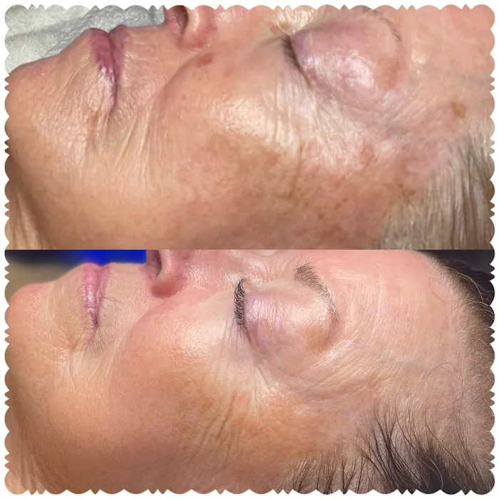 Skin by Von Picture 3