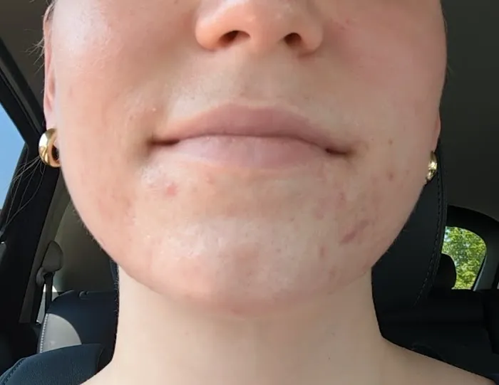 Kiki Beauty Picture 4