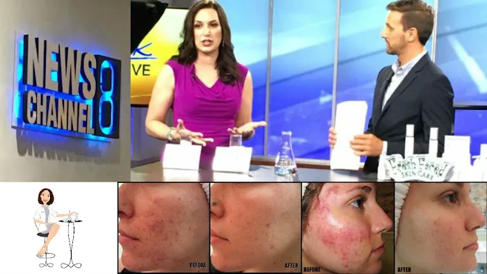 Fresh Faced Skin Care Picture 8