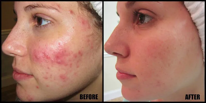 Fresh Faced Skin Care Picture 10