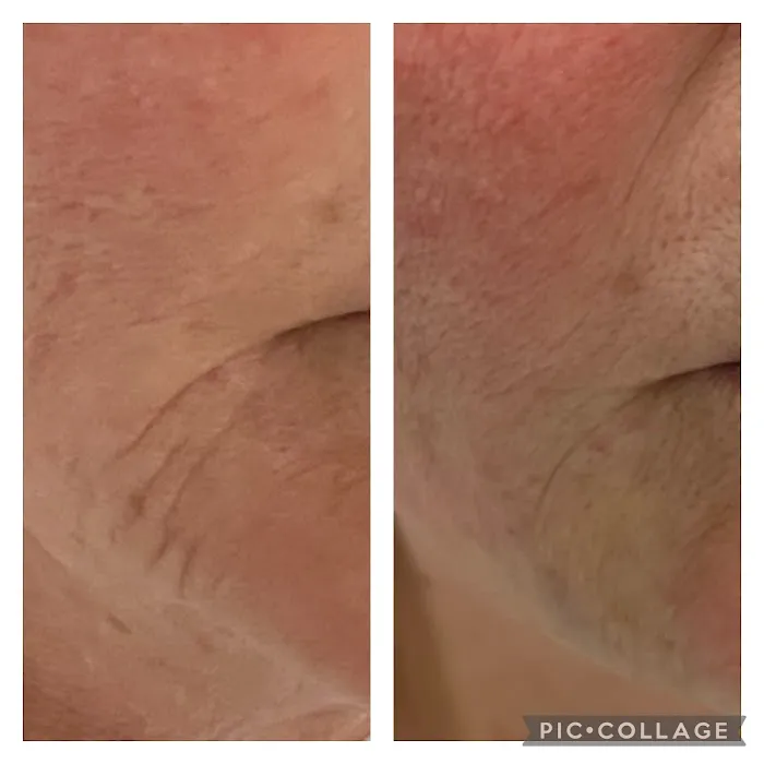 The Skin Rejuvenator Picture 4