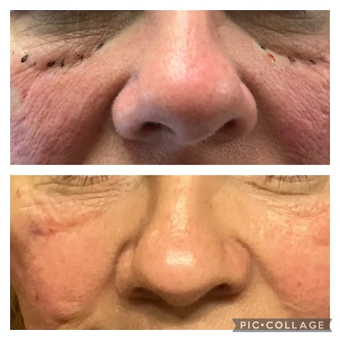 The Skin Rejuvenator Picture 5