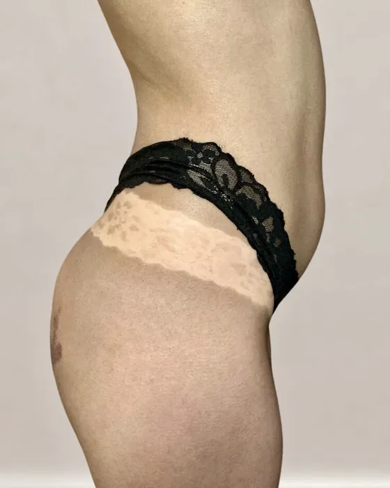 Middle Ground Aesthetics Picture 8